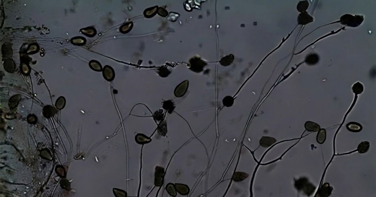 Nấm Phytophthora spp. kết hợp với các nấm đất khác tấn công hồ tiêu